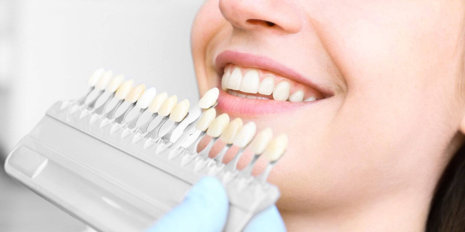 чистка зубов отбеливание уфа