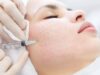 Биоревитализация лица после процедуры